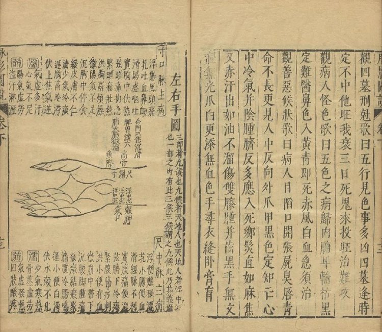 脉经插图3 脉经插图3