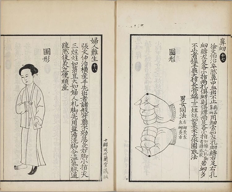 备急灸方插图3