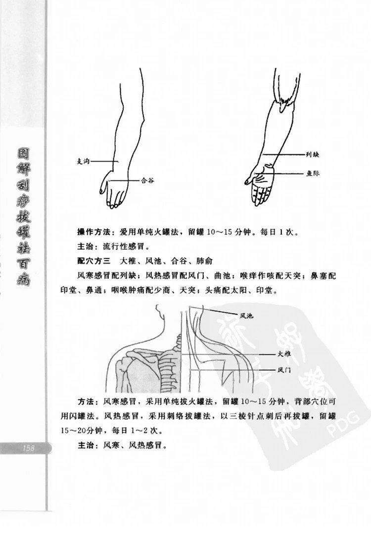 图解刮痧拔罐祛百病插图3